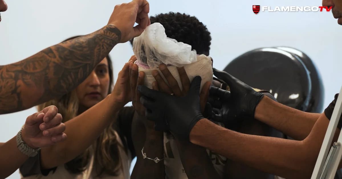 Jogador do Flamengo com molde para máscara após fratura nasal no vestiário, equipe médica e colegas lesionados ao fundo.